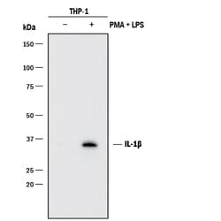 Human IL-1 beta/IL-1F2 Antibody, R D Systems 500&mu;g; Unlabeled:Antibodies,