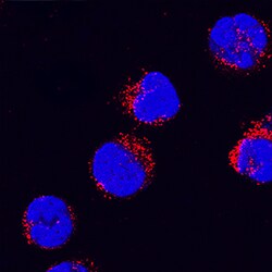 Human IL-1 beta/IL-1F2 Propeptide Antibody, R D Systems 25&mu;g; Unlabeled:Antibodies,