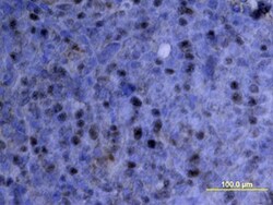 Human IL-10 Antibody, R D Systems 25&mu;g; Unlabeled:Antibodies, Polyclonal