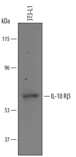 Mouse IL-10 R beta Antibody, R D Systems 100&mu;g; Unlabeled:Antibodies,