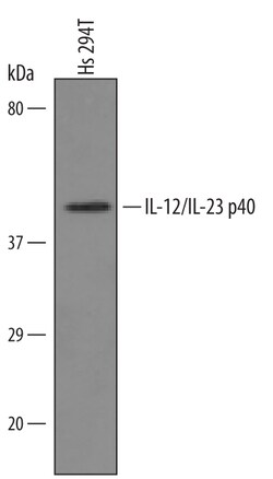 Human IL-12/IL-23 p40 Antibody, R D Systems 100&mu;g; Unlabeled:Antibodies,