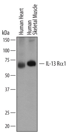 Human IL-13 R alpha 1 Antibody, R D Systems 100ug; Unlabeled:Antibodies,