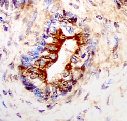Human IL-13 R alpha 2 Antibody, R D Systems 100&mu;g; Unlabeled:Antibodies,