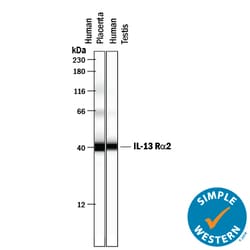 Human IL-13 R alpha 2 Antibody, R D Systems 100&mu;g; Unlabeled:Antibodies,