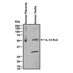 Human IL-13 R alpha 2 Antibody, R D Systems 100&mu;g; Unlabeled:Antibodies,