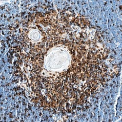 Mouse IL-13 R alpha 2 Antibody, R D Systems 25&mu;g; Unlabeled:Antibodies,