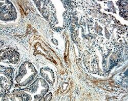 Human IL-15R alpha Antibody, R D Systems 100&mu;g; Unlabeled:Antibodies,
