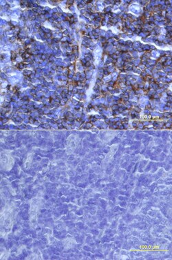 Human IL-16 C-terminal Peptide Antibody, R D Systems 25&mu;g; Unlabeled:Antibodies,