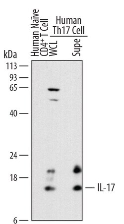 Human IL-17/IL-17A Antibody, R D Systems 100&mu;g; Unlabeled:Antibodies,