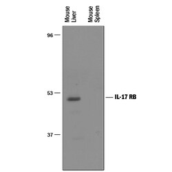 Mouse IL-17RB Antibody, R D Systems 25&mu;g; Unlabeled:Antibodies, Polyclonal