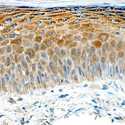 Human IL-17C Antibody, R D Systems 500ug; Unlabeled:Antibodies, Monoclonal
