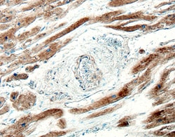 Human IL-17D Antibody, R D Systems 25&mu;g; Unlabeled:Antibodies, Monoclonal