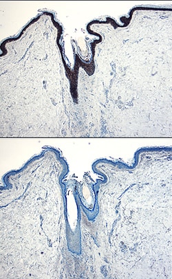 Human IL-1ra/IL-1F3 Antibody, R D Systems 100&mu;g; Unlabeled:Antibodies,