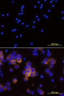 Human CD25/IL-2R alpha Antibody, R D Systems:Antibodies:Primary Antibodies