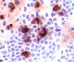 Human CD25/IL-2R alpha Antibody, R D Systems:Antibodies:Primary Antibodies