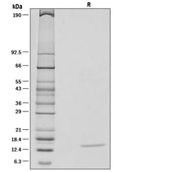 R&D Systems™ Recombinant Human IL-22 Protein