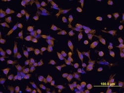 IL-22R alpha 1 Rat anti-Mouse, Clone: 496514, R D Systems 25&mu;g; Unlabeled,