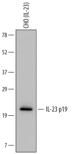 Human IL-23 p19 Antibody, R D Systems 50&mu;g; Unlabeled:Antibodies, Polyclonal