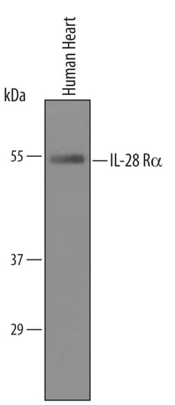 Human IL-28 R alpha/IFN-lambda R1 Antibody, R D Systems 25&mu;g; Unlabeled:Antibodies,