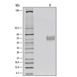 R D Systems Recombinant Human IL-3R alpha/CD123 Protein 25 &mu;g | Buy Online | R&amp;D Systems&trade; | Fisher Scientific