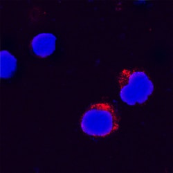 Human IL-31 Antibody, R D Systems 100&mu;g; Unlabeled:Antibodies, Polyclonal
