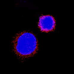 Human IL-31RA Antibody, R D Systems 25&mu;g; Unlabeled:Antibodies, Polyclonal