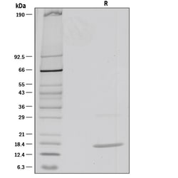 R&D Systems&trade;&nbsp;Recombinant Mouse IL-36 beta/IL-1F8 (aa 31-183) Protein