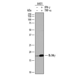 Human IL-36 gamma/IL-1F9 Antibody, R D Systems 25&mu;g; Unlabeled:Antibodies,