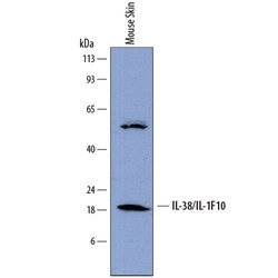 IL-38/IL-1F10 Rat anti-Mouse, Clone: 798036, R D Systems 25&mu;g; Unlabeled,