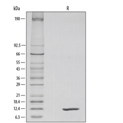 R&amp;D Systems&trade;&nbsp;Recombinant Mouse IL-4 Protein:  