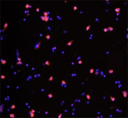 Porcine IL-4 Antibody, R D Systems 25&mu;g; Unlabeled:Antibodies, Polyclonal