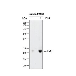 Human IL-6 Antibody, R D Systems 100&mu;g; Unlabeled:Antibodies, Polyclonal
