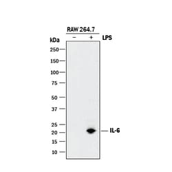 Mouse IL-6 Antibody, R D Systems 25&mu;g; Unlabeled:Antibodies, Polyclonal