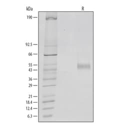 R D Systems Recombinant Human IL-6R alpha Protein 25 &mu;g | Buy Online | R&amp;D Systems&trade; | Fisher Scientific