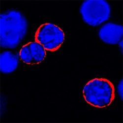 Mouse IL-6R alpha Antibody, R D Systems 100 &mu;g | Buy Online | R&D Systems | Fisher Scientific