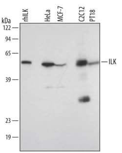 Human/Mouse/Rat ILK Antibody, R D Systems 100ug; Unlabeled:Antibodies,