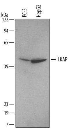 Human/Mouse/Rat ILKAP/PP2C delta Antibody, R D Systems 25&mu;g; Unlabeled:Antibodies,