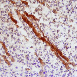 Mouse Indian Hedgehog/Ihh N-Terminus Antibody, R D Systems 100&mu;g; Unlabeled:Antibodies,