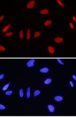 Human ING1 Antibody, R D Systems 25&mu;g; Unlabeled:Antibodies, Polyclonal