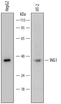 Human/Mouse ING1 Antibody, R D Systems 100ug; Unlabeled:Antibodies, Monoclonal