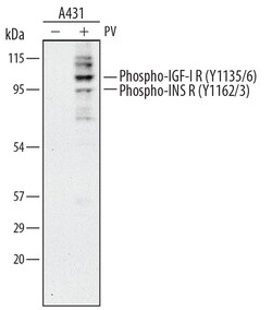 Human Phospho-Insulin R (Y1162/Y1163)/ IGF-I R (Y1135/Y1136) Antibody, R D Systems 25 &mu;g | Buy Online | R&D Systems | Fisher Scientific
