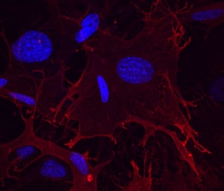 Mouse Integrin alpha 11 Antibody, R D Systems 100&mu;g; Unlabeled:Antibodies,
