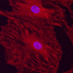 Human/Mouse/Rat Integrin alpha V/CD51 Antibody, R D Systems 100&mu;g; Unlabeled:Antibodies,