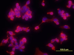 Human Integrin alpha V/CD51 Antibody, R D Systems 500 &mu;g | Buy Online | R&D Systems | Fisher Scientific