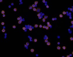Human Integrin beta 2/CD18 Antibody, R D Systems 25&mu;g; Unlabeled:Antibodies,