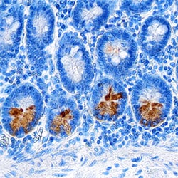 Human Intelectin-2 Antibody, R D Systems 100ug; Unlabeled:Antibodies, Monoclonal
