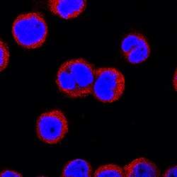 Human IRAK4 Antibody, R D Systems 25&mu;g; Unlabeled:Antibodies, Polyclonal