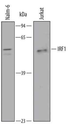 Human IRF1 Antibody, R D Systems 100&mu;g; Unlabeled:Antibodies, Polyclonal