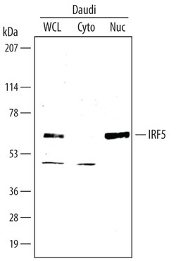 Human IRF5 Antibody, R D Systems 100 &mu;g | Buy Online | R&D Systems | Fisher Scientific