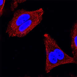 Human IRS1 Antibody, R D Systems 100 &mu;g | Buy Online | R&D Systems | Fisher Scientific